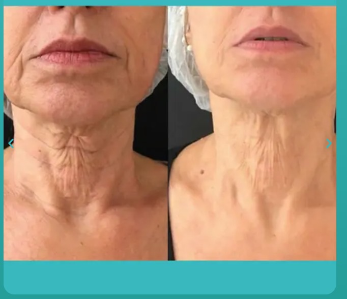 Teste form 3 9b91097a-0a96-400d-9aed-8398d940a8e3