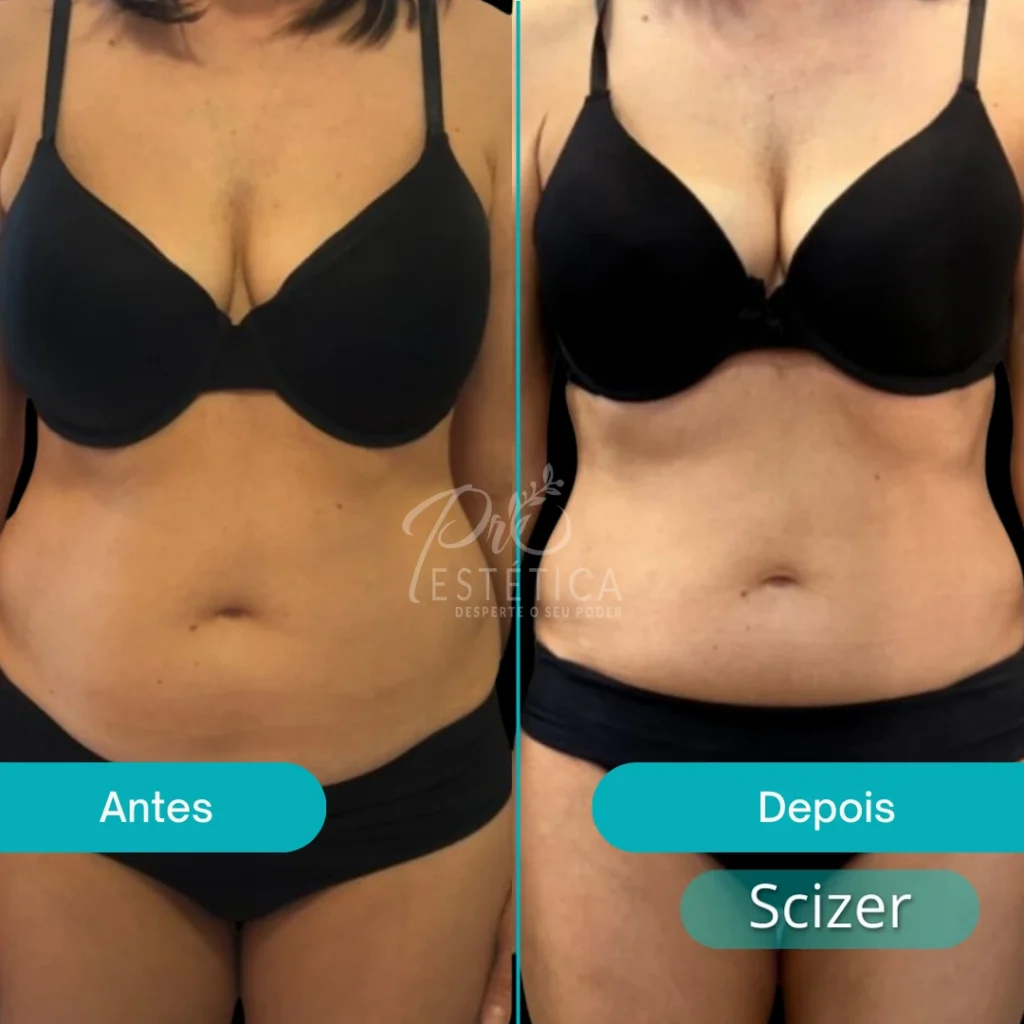 Scizer 10 scizer 4