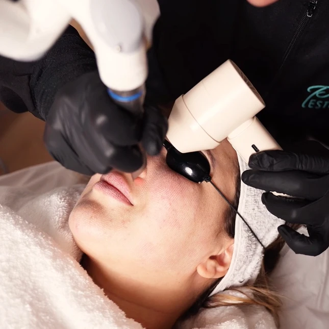 flacidez facial