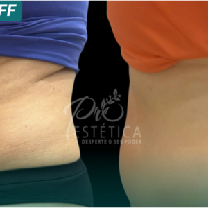 Powershape – 10 sessões